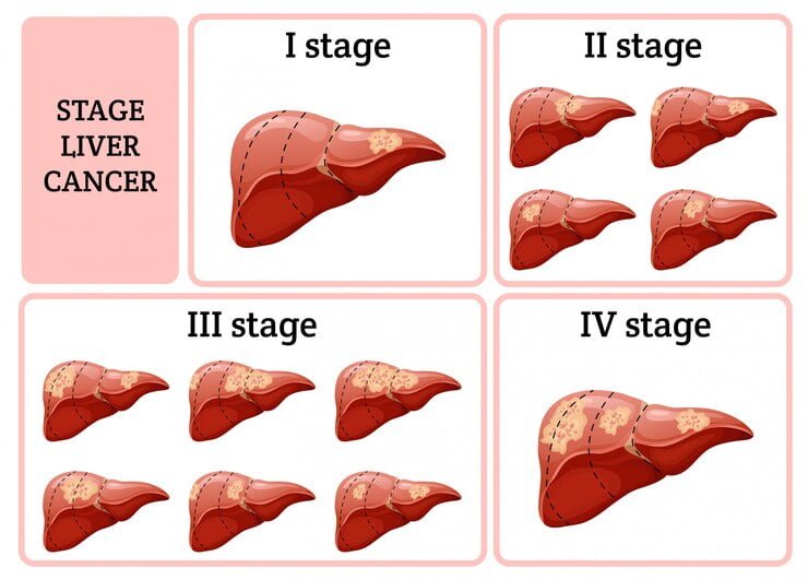 Can you Feel your Liver is healing?